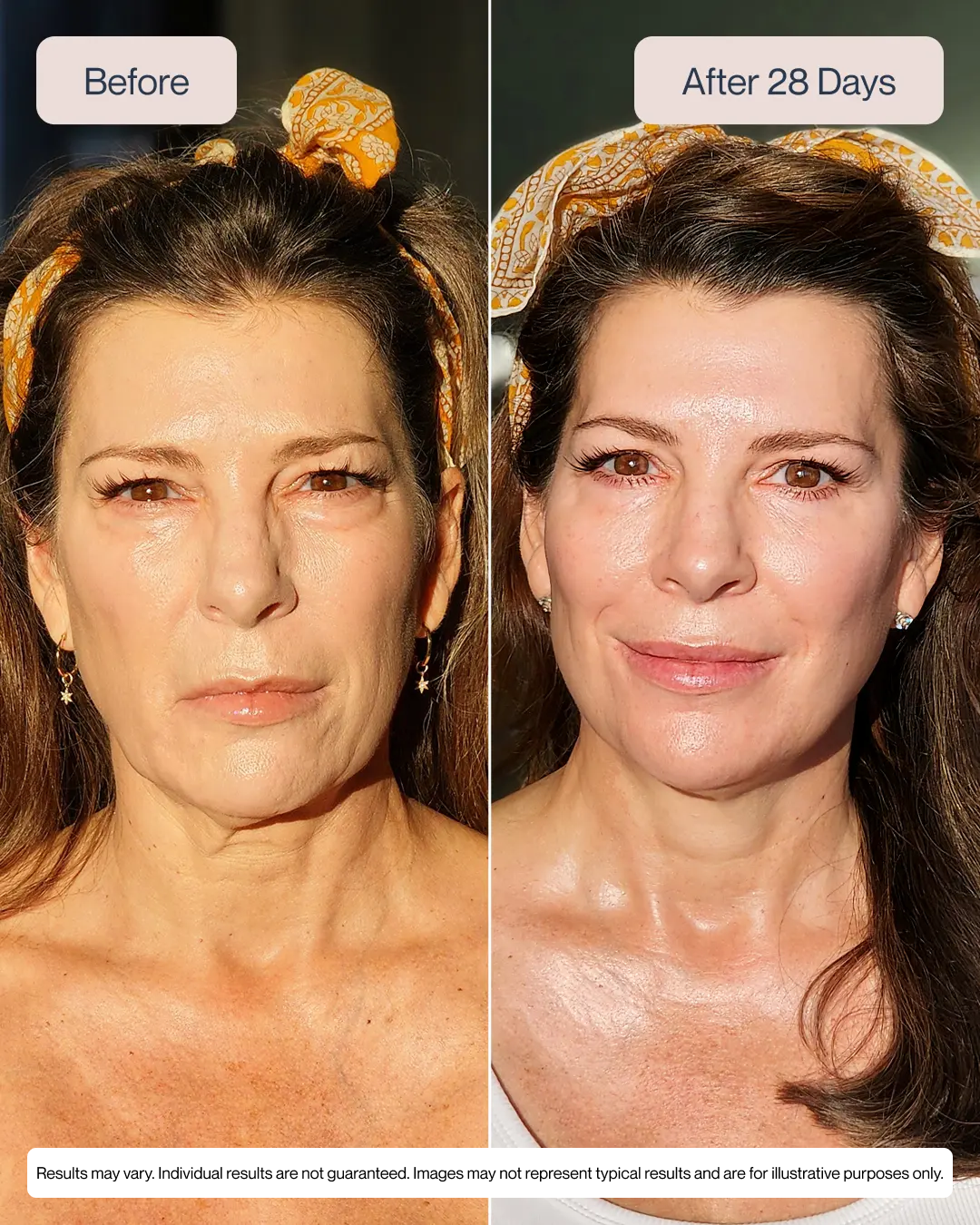 Anti-Aging Eye Lifting Device with Microcurrent and Vibration Modes