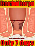 Handheld Comfort Pen for Targeted Relief in Sensitive Areas